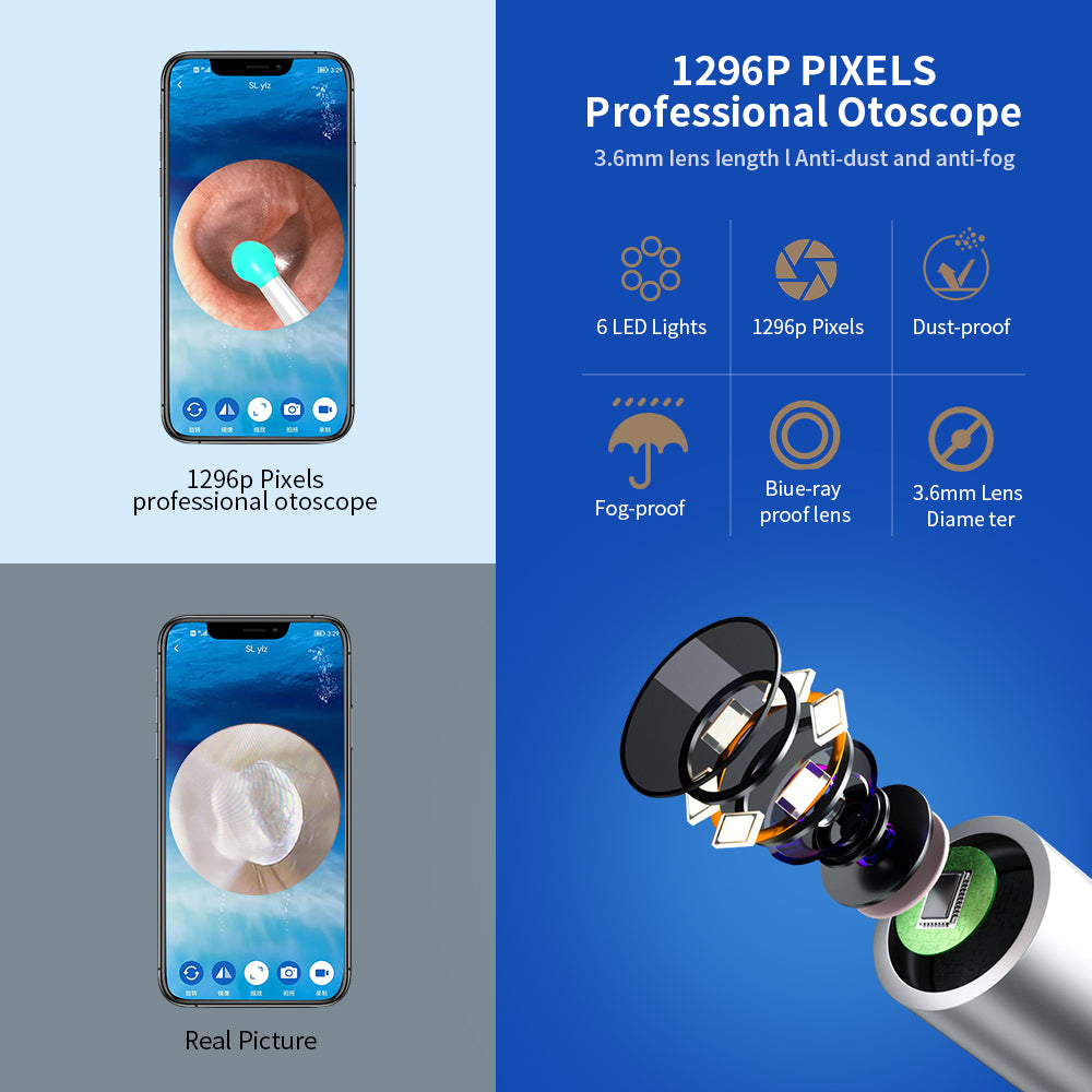 NE3 Ear Wax Tool With Camera